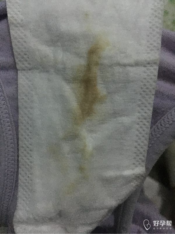 前两天一直有果冻状的东西流出,还挺多的,所以一直用护垫,早上起来