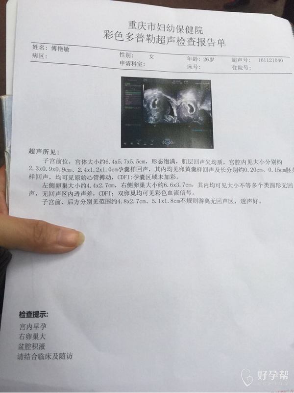 怀孕多久可以看是不是宫内孕 gw-topic