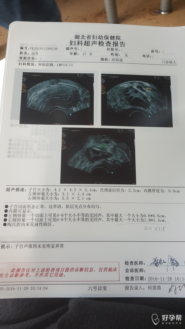 多囊卵巢,现在排卵不大,不知道怎么办了