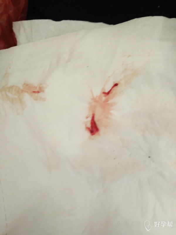 已经第二次见红了01怎么办