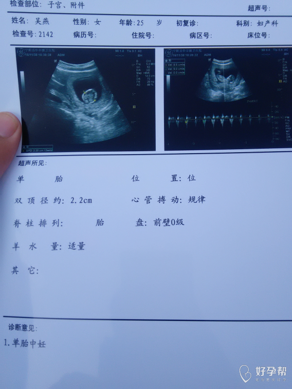 孕13周了期待宝宝健健康康足月出生