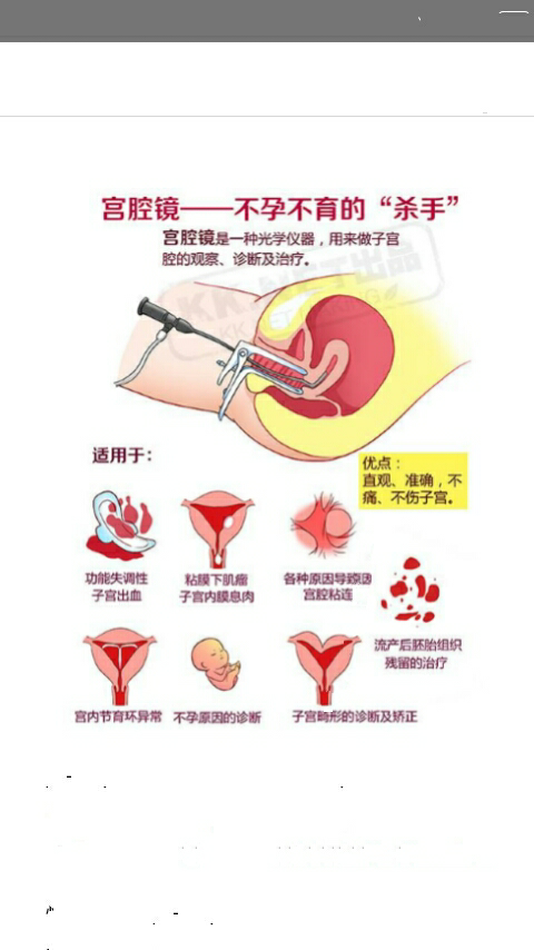 宫颈息肉图片治疗方法图片