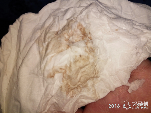 89褐色脏东西时有时无一点血没有,大夫让继续保胎,求助我这种情况保胎