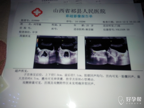 几个月做nt检查 gw-topic