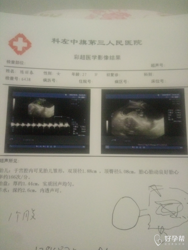 12周了剛剛做了彩超