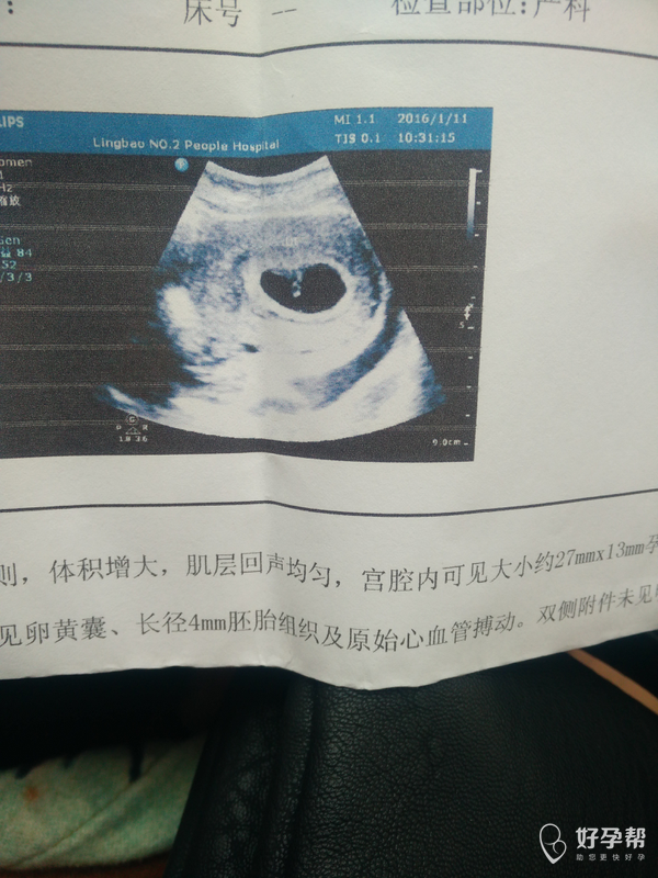 亲们给看一下男孩女孩!