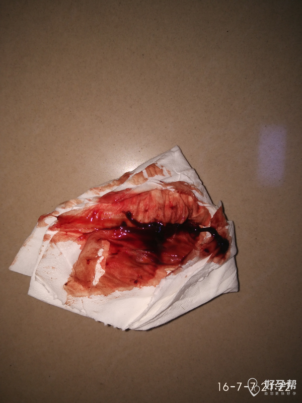 薇薇_989316 发布 最新评论 啊清 1楼 好像有个像肉又有点像血的,一坨