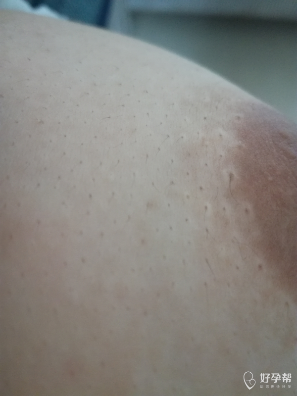 就慢慢的开始长一些胸毛～[汗][汗]