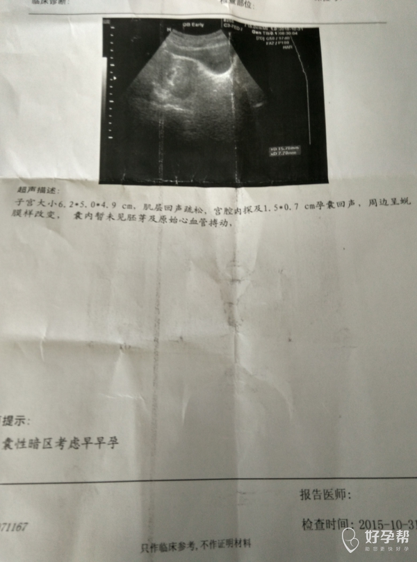 什么原因导致孕囊小 gw-topic