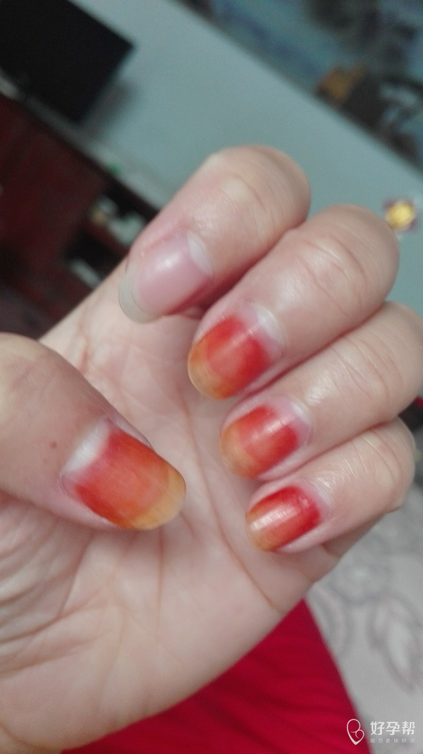看看我用家桃花染的指甲