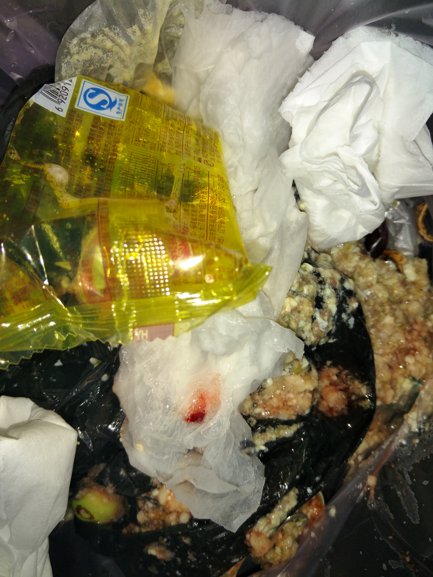 孕吐吐血了严重吗怎么办