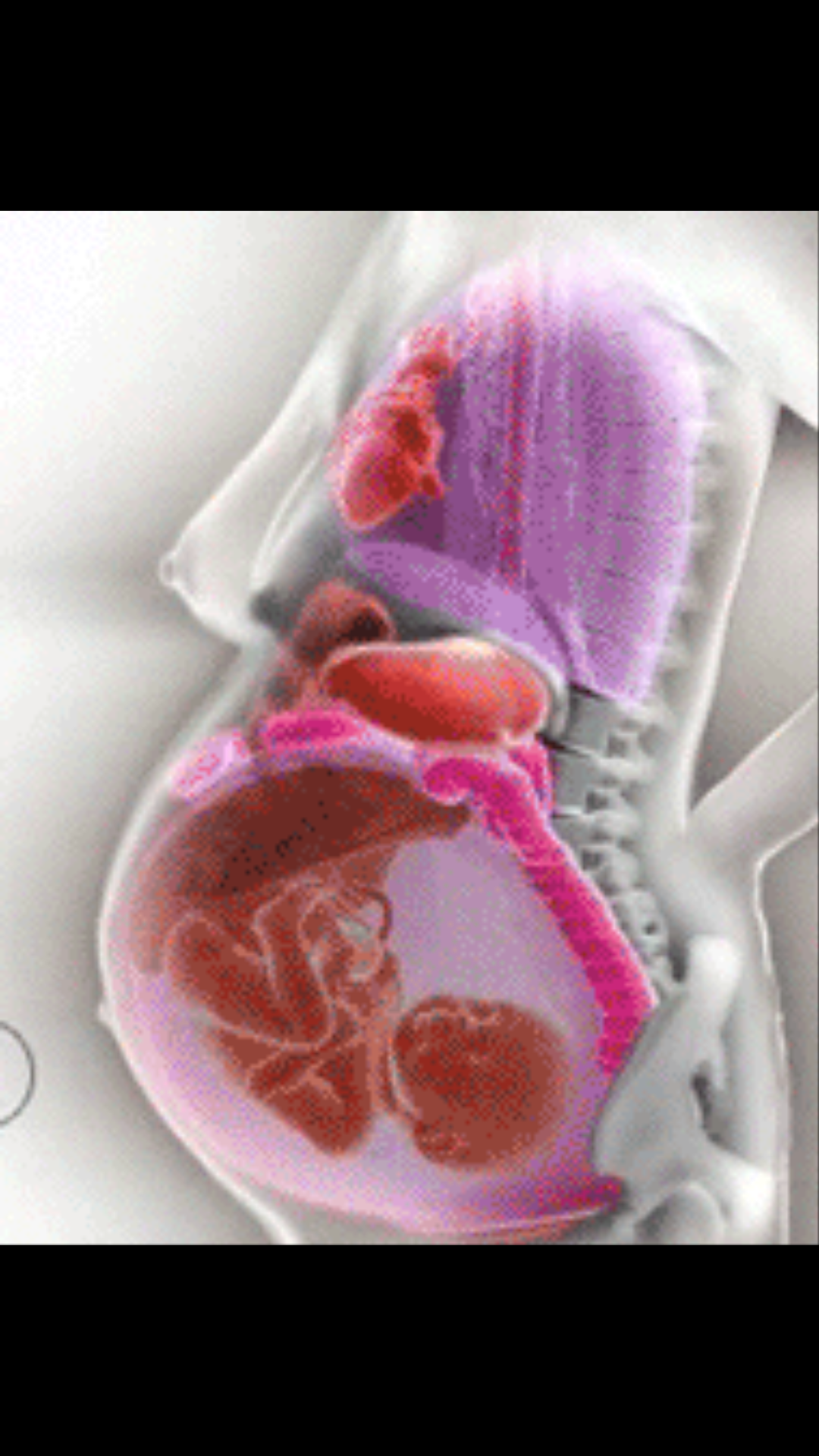 胎儿挤压内脏图片图片