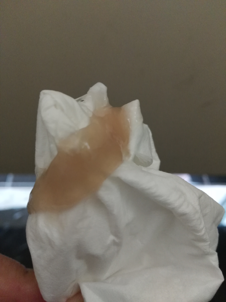 亲爱的姐妹们帮我看看这种白带是怎么了