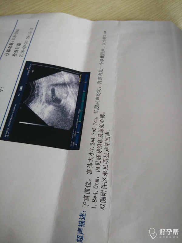 怀孕7周b超验血归来