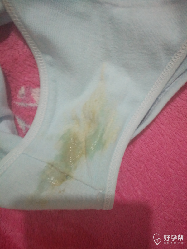 内裤上天天这样子,这是怎么了