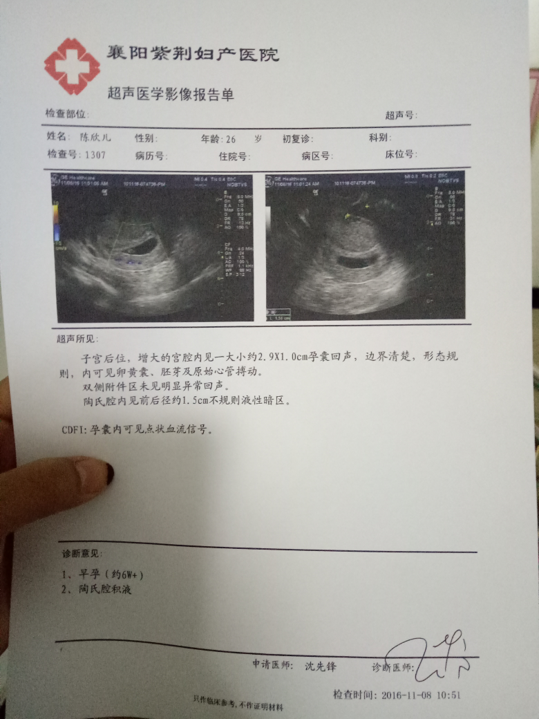 孕6周有胎心胎芽胎跳但是谢谢陶氏腔积液