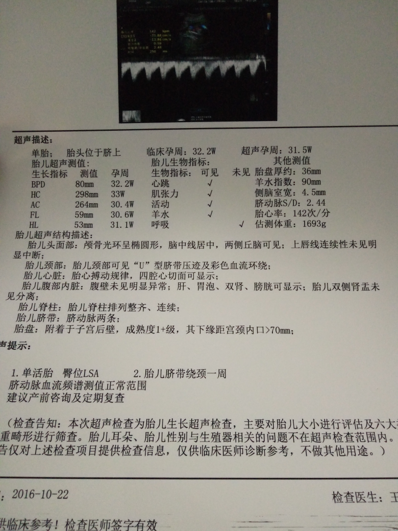 帮忙看看这个问题大不大