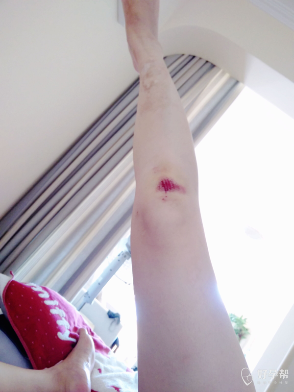 今天摔了一跤悲催幸亏娃没事