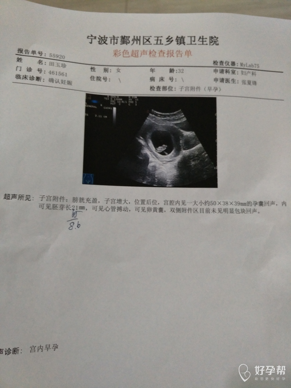 田甜_591425 发布 10