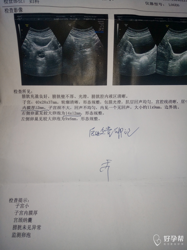 隔两天测的卵泡是不是多囊呢子宫大小呢