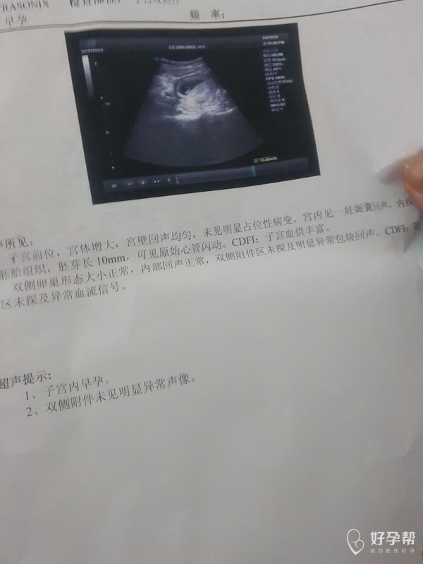 2016-04-19 17:14:0422更多备孕好书免费领取>