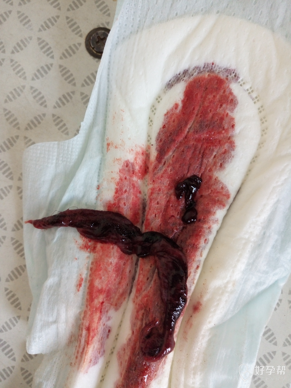 2016-08-15 16:12:230更多备孕好书免费领取>