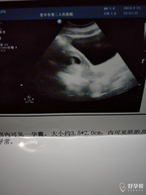 怀孕50多天照比超能看出男女吗