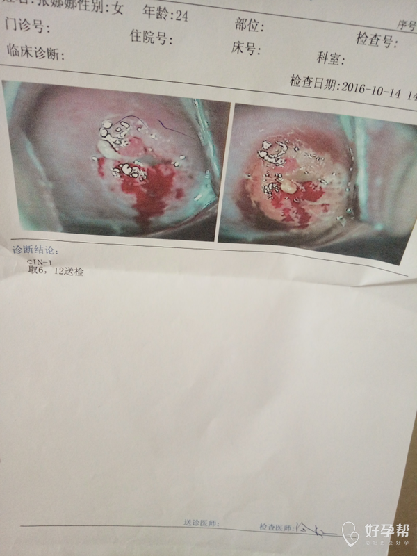 子宫糜烂,吃药能治好吗?