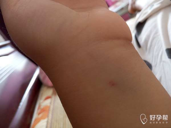 人家输液也没那么麻烦,到我可好了,除了找不到血管,要不跑针,要不就古