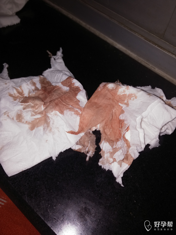 怎么回事又出血了 着急!