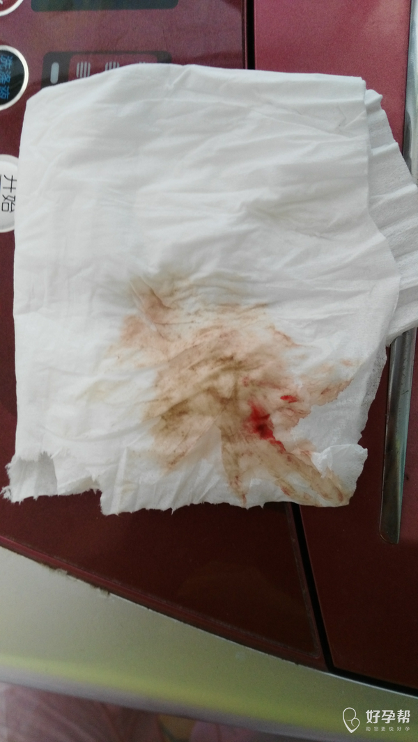 排卵期出血,有姐妹这样吗