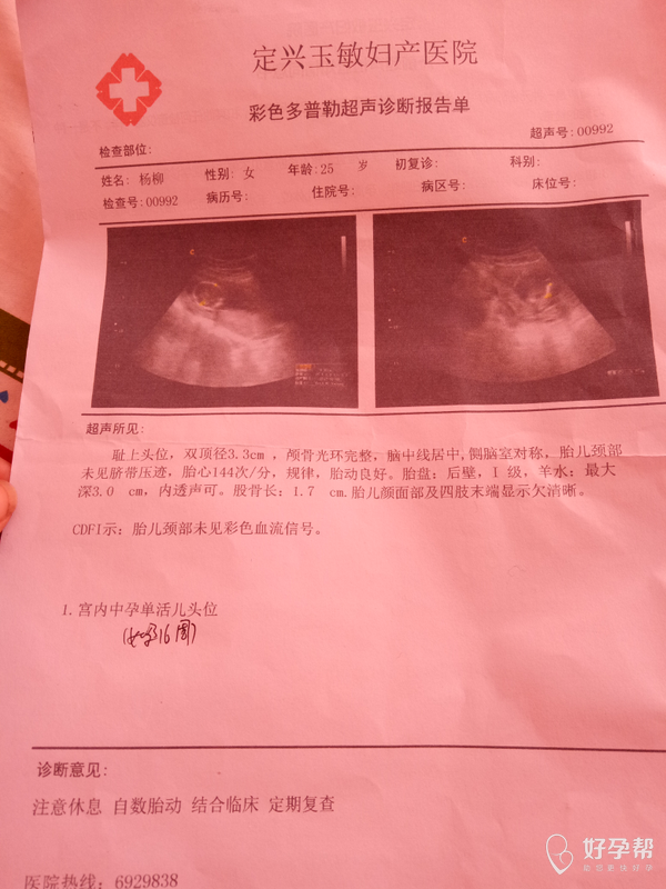 精彩!女生怀孕一周最突出的征兆"盛情款待"-第1张图片-萨芬博客