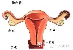 月经,看你往哪里跑! - 子宫内膜异位症 - 好孕帮