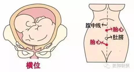 孕周胎心的位置示意图图片