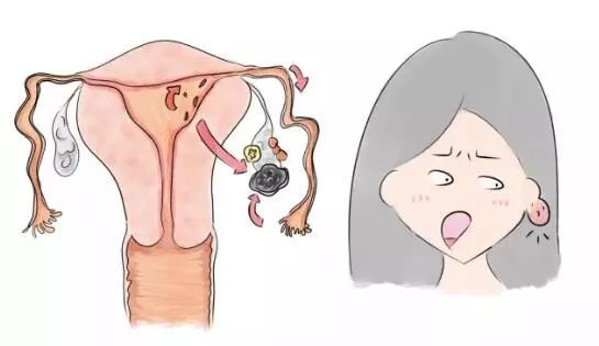 折磨死人的子宫内膜异位症!要怎么才能缓解和怀孕?