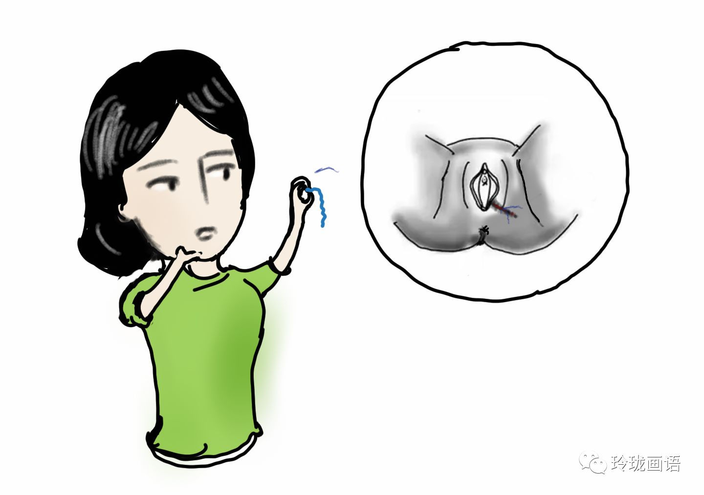 会阴侧切在愈合过程中,有些女性会发生下列的情况:从阴道到肛门之间