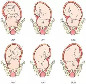 胎头的矢状缝解剖图图片