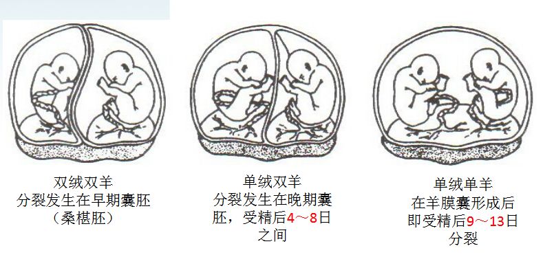 绝大多数双卵双胎为双绒毛膜双羊膜囊双胎.