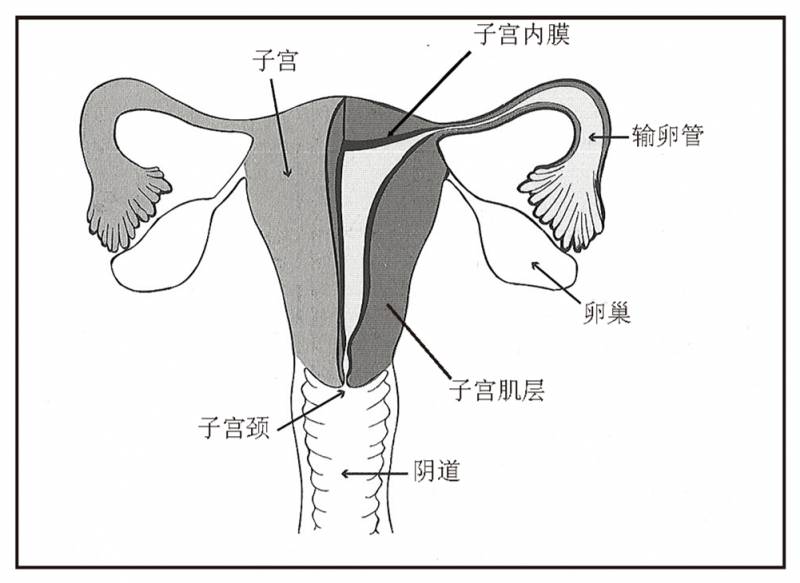 子宫内膜异位症到底是怎么回事?