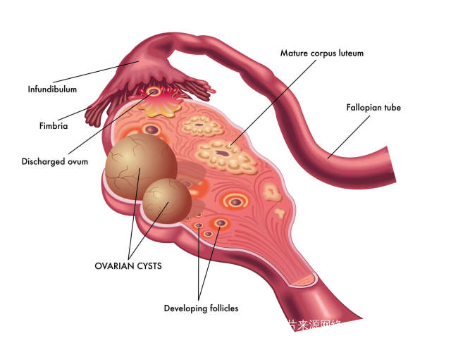 子宫内膜增生的原因