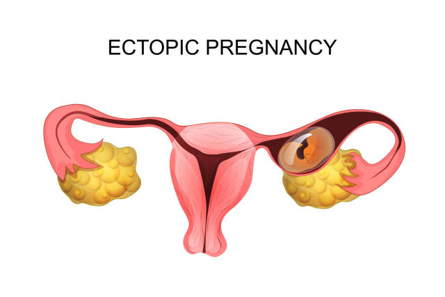 卵巢发育不良怎么办