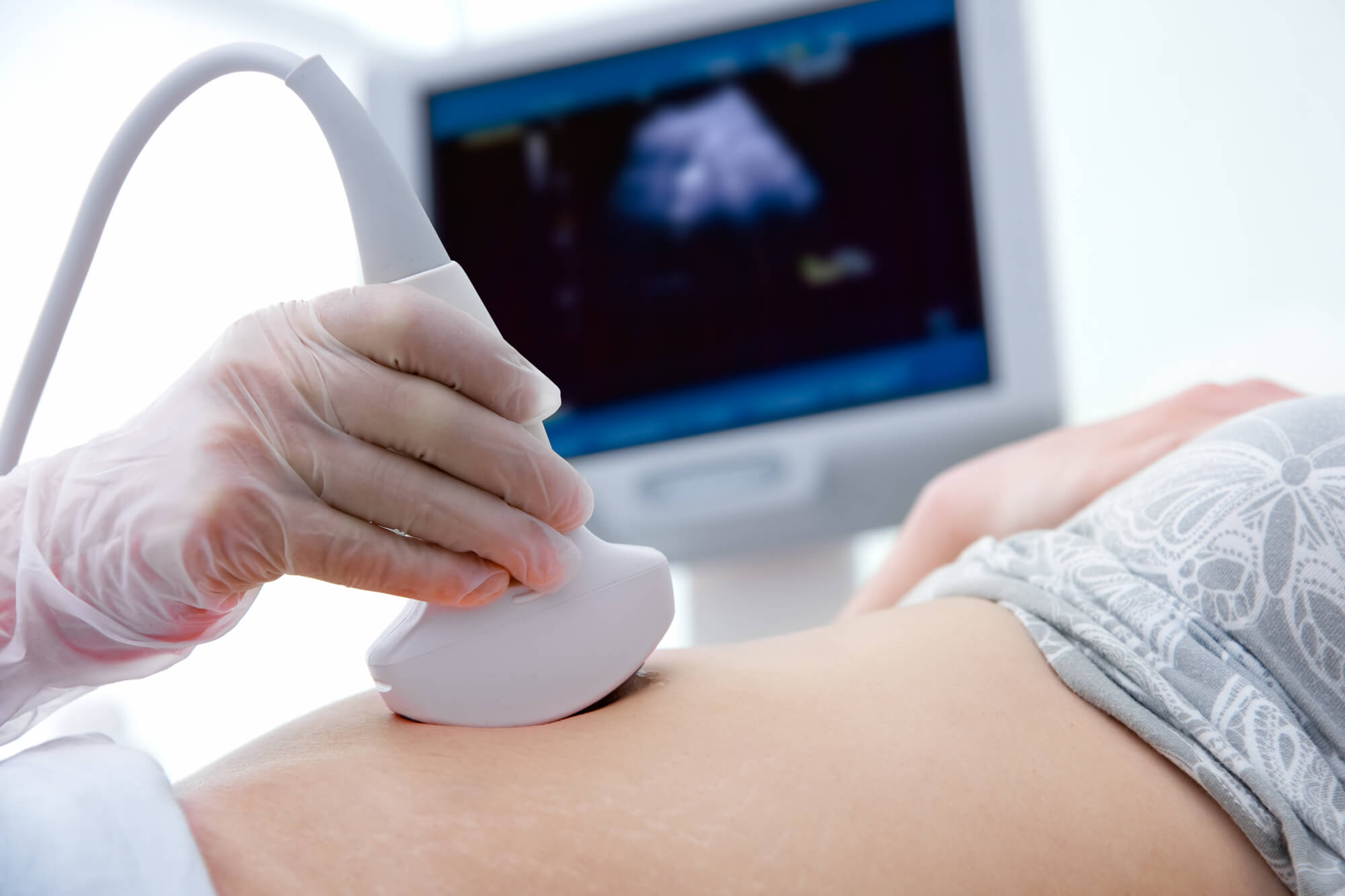 子宫内膜异位症会影响怀孕吗