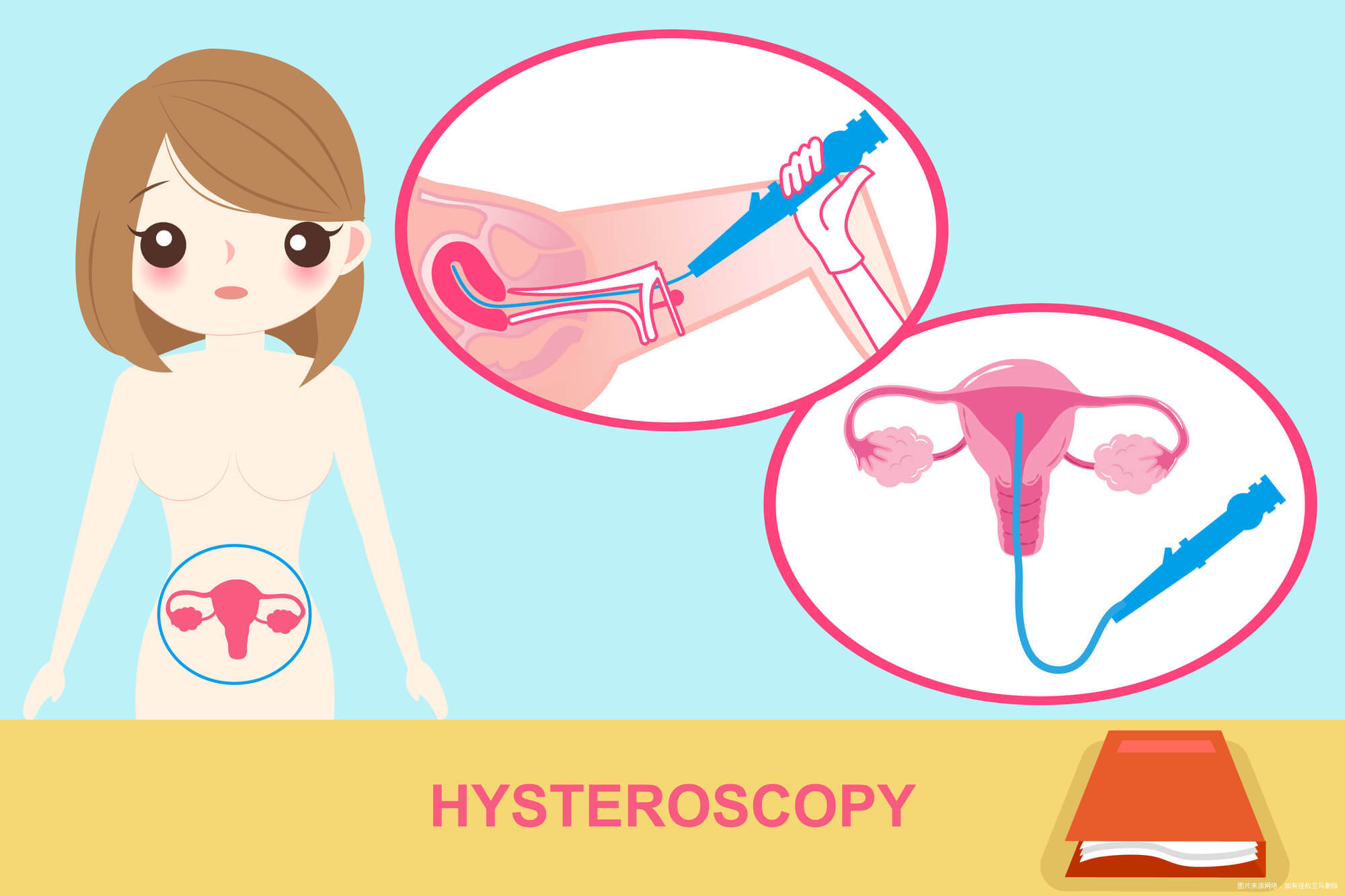 卵巢囊肿微创手术过程