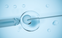 促排卵+宫腔内人工授精，你了解吗？