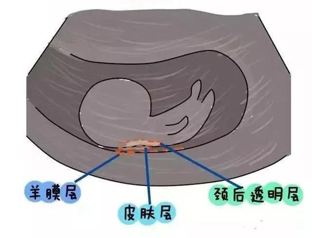 微信图片_20181020145029.jpg