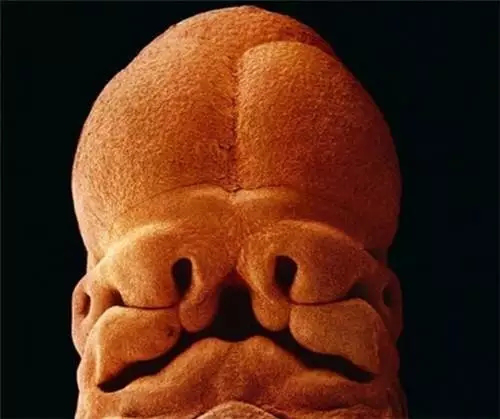 blob.png