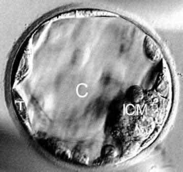 blastocyst.jpg