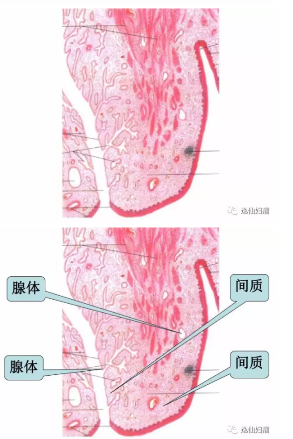 14.png