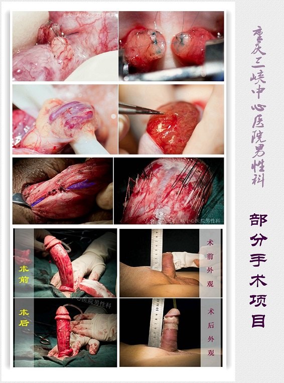 手术项目.jpg