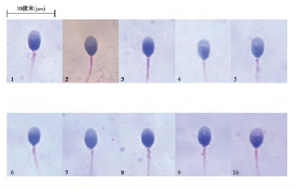 精子畸形的图片.jpg